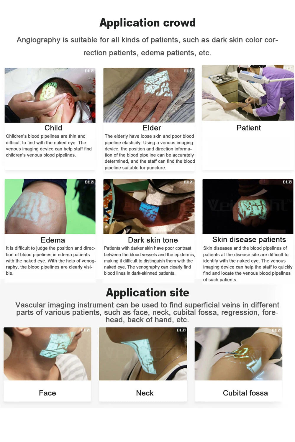 VeinSight Pro HF-410A | Handheld Near-Infrared Vein Finder & Locator for Nurses and Medical Use